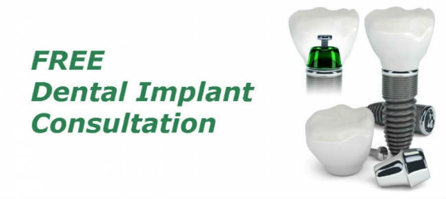 Free Dental Implant Consultation