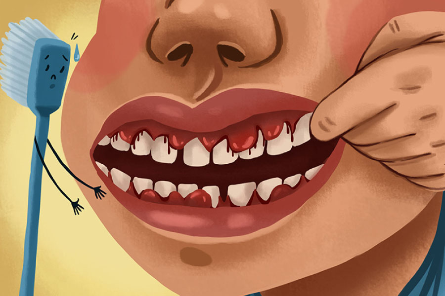 Cartoon of a patient with bleeding gums indicative of gum disease.